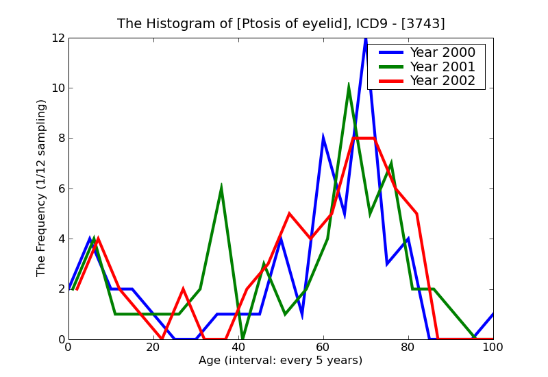 ICD9 Histogram Ptosis of eyelid