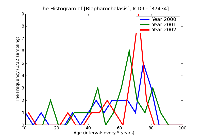ICD9 Histogram Blepharochalasis