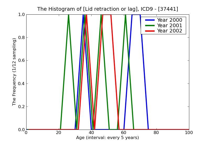 ICD9 Histogram Lid retraction or lag