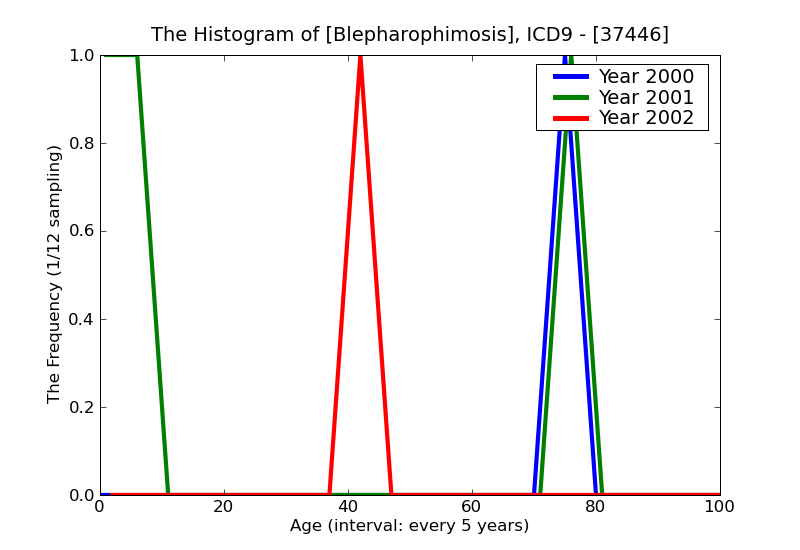 ICD9 Histogram Blepharophimosis