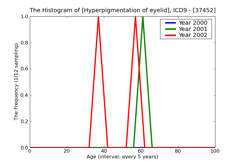 ICD9 Histogram Hyperpigmentation of eyelid