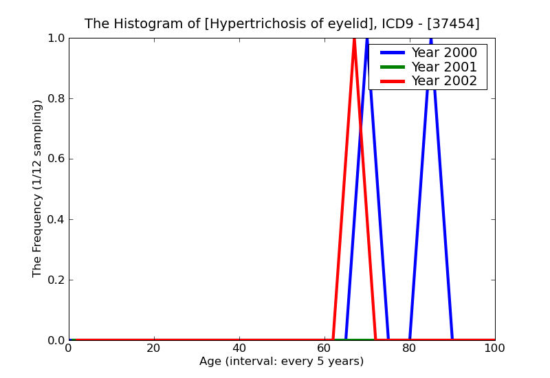 ICD9 Histogram Hypertrichosis of eyelid
