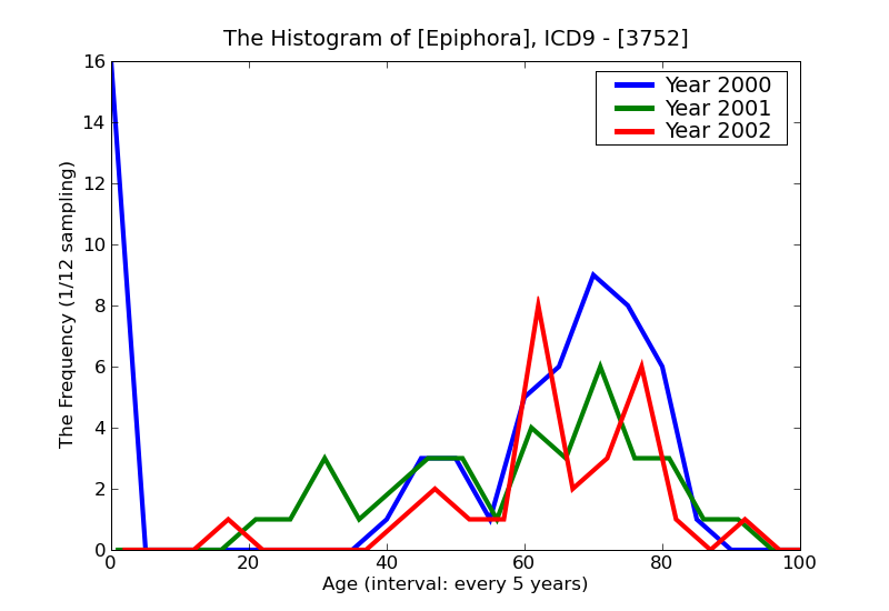 ICD9 Histogram Epiphora