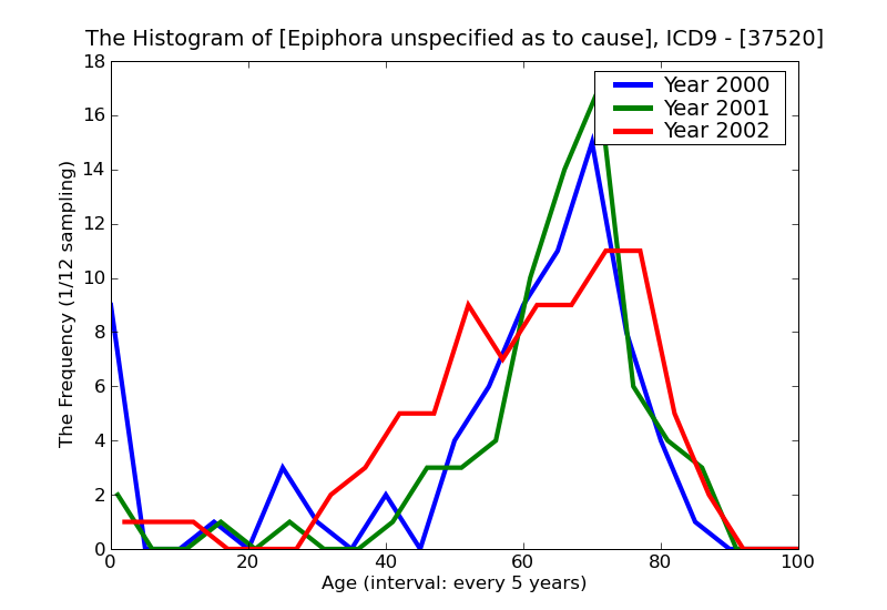 ICD9 Histogram Epiphora unspecified as to cause