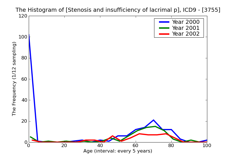 ICD9 Histogram Stenosis and insufficiency of lacrimal passages