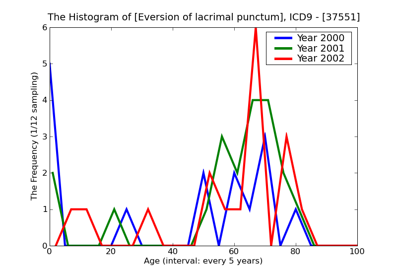 ICD9 Histogram Eversion of lacrimal punctum