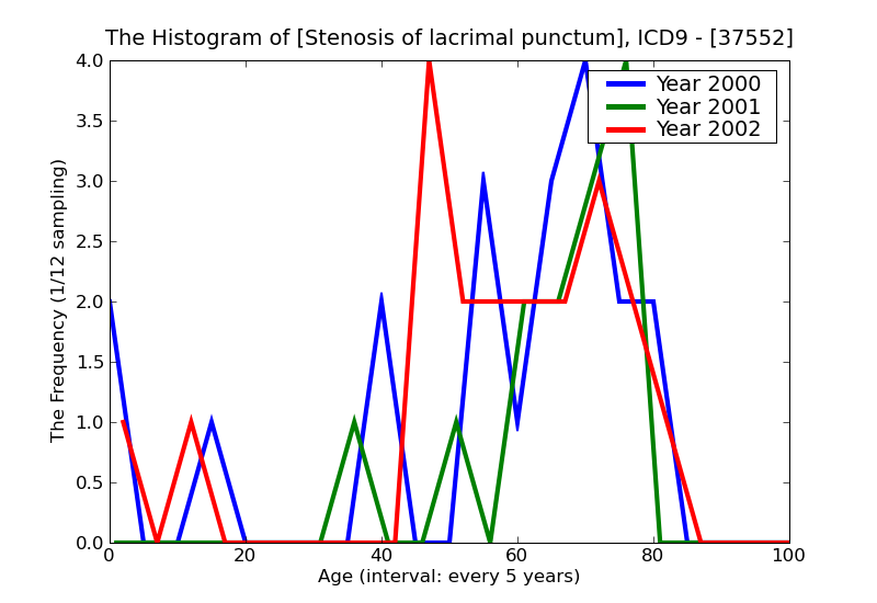 ICD9 Histogram Stenosis of lacrimal punctum