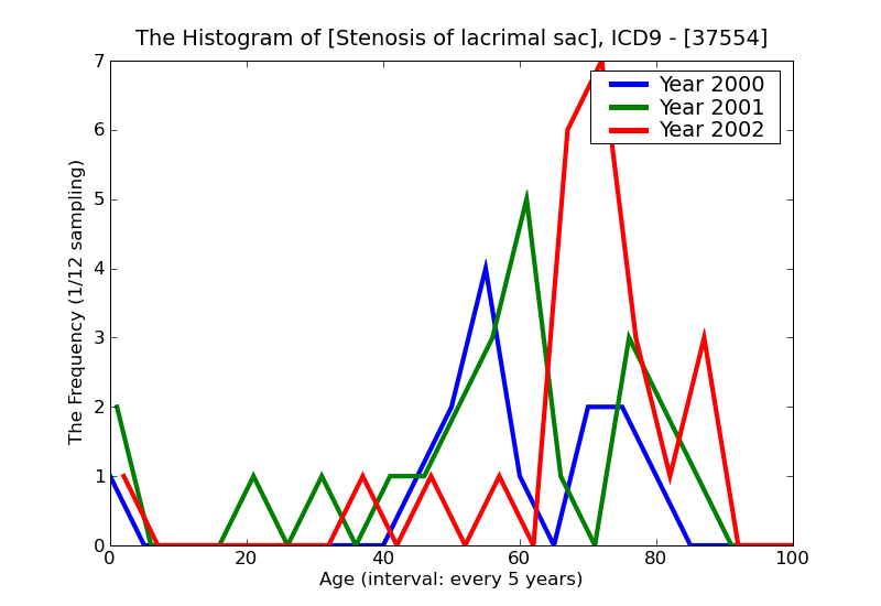 ICD9 Histogram Stenosis of lacrimal sac