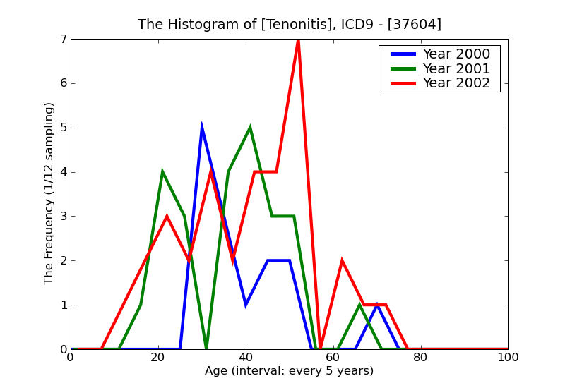 ICD9 Histogram Tenonitis