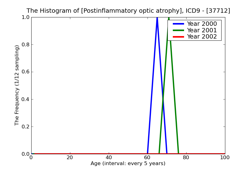 ICD9 Histogram Postinflammatory optic atrophy