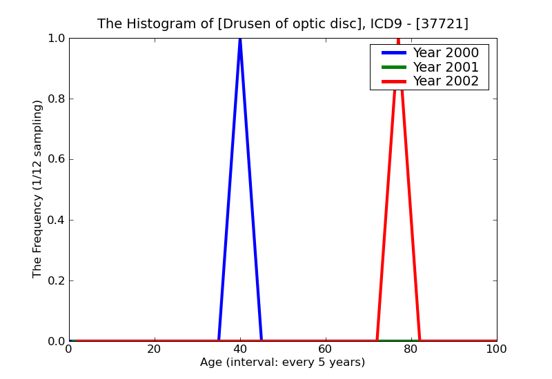 ICD9 Histogram Drusen of optic disc