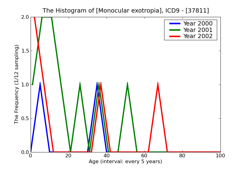 ICD9 Histogram Monocular exotropia