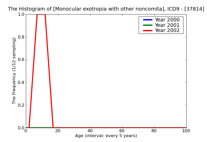 ICD9 Histogram Monocular exotropia with other noncomitancies