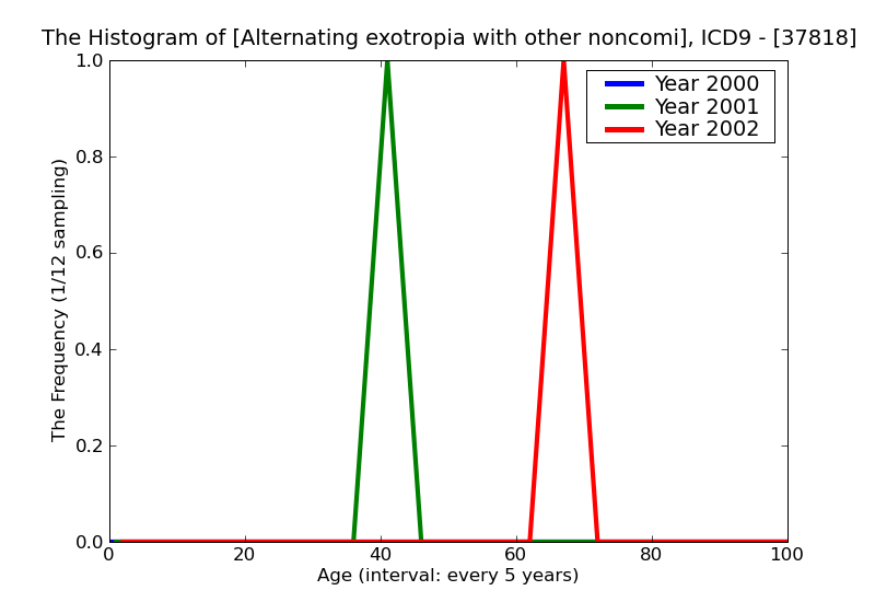 ICD9 Histogram Alternating exotropia with other noncomitancies