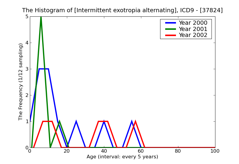 ICD9 Histogram Intermittent exotropia alternating