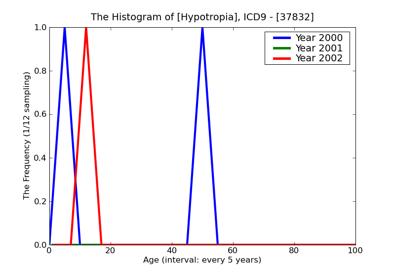 ICD9 Histogram Hypotropia