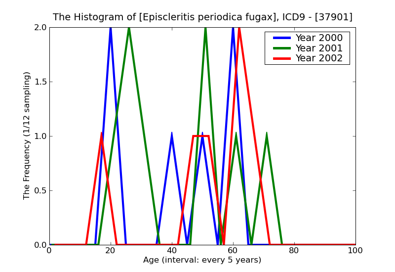 ICD9 Histogram Episcleritis periodica fugax