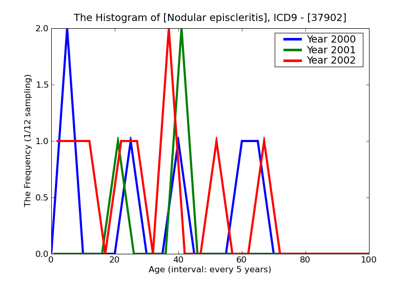 ICD9 Histogram Nodular episcleritis