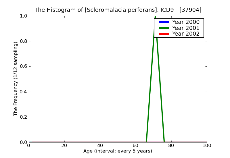 ICD9 Histogram Scleromalacia perforans