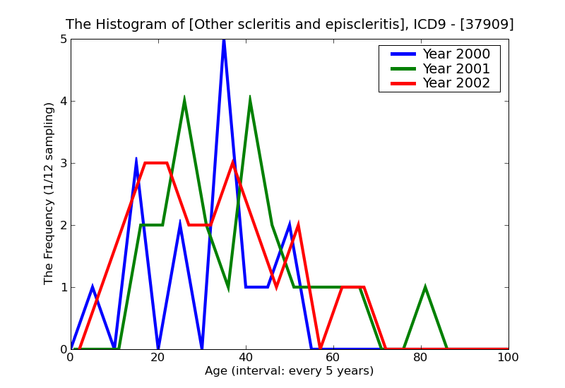 ICD9 Histogram Other scleritis and episcleritis