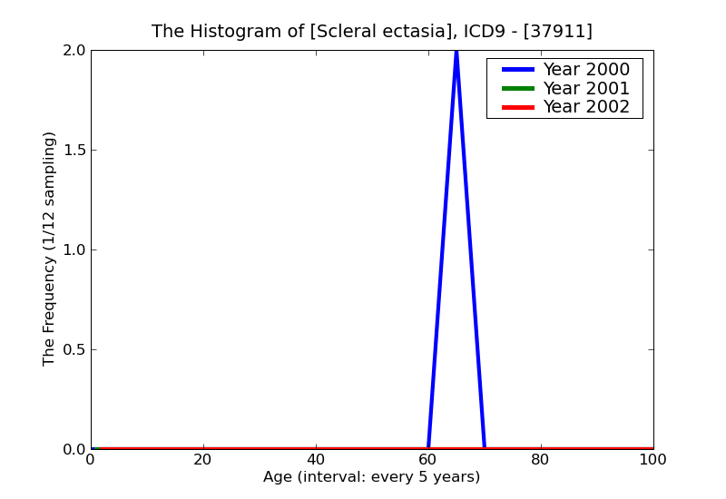 ICD9 Histogram Scleral ectasia