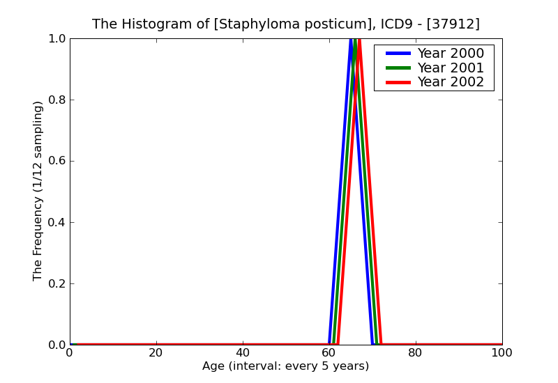 ICD9 Histogram Staphyloma posticum