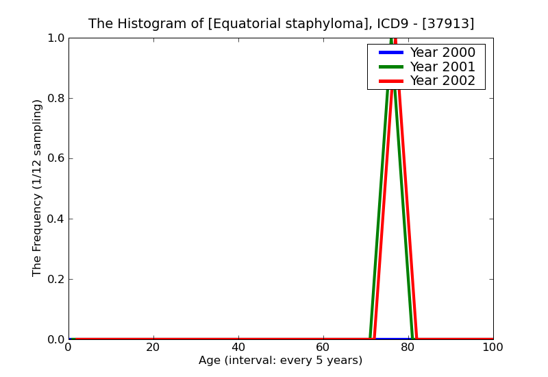 ICD9 Histogram Equatorial staphyloma