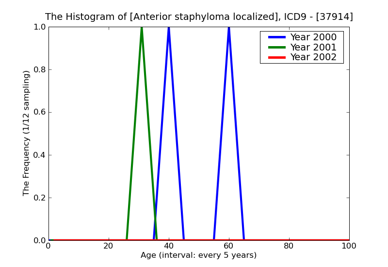 ICD9 Histogram Anterior staphyloma localized