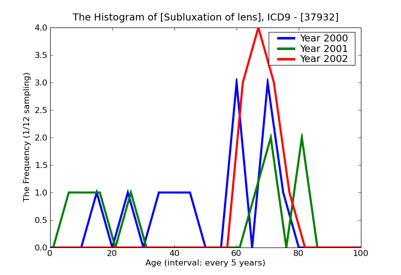 ICD9 Histogram Subluxation of lens