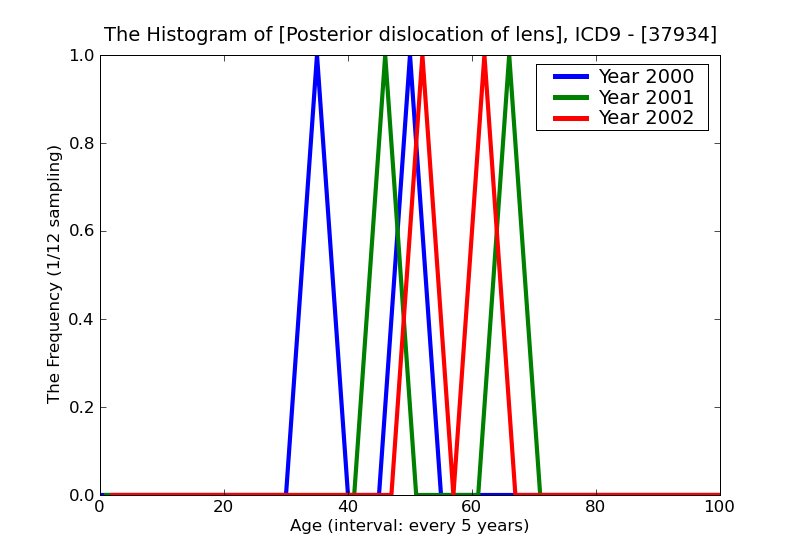 ICD9 Histogram Posterior dislocation of lens