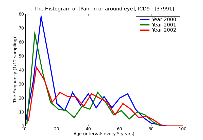 ICD9 Histogram Pain in or around eye