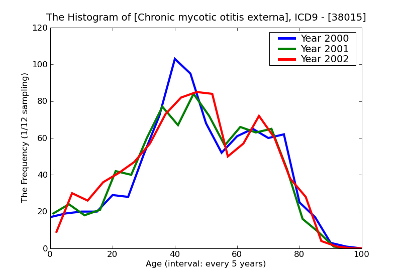 ICD9 Histogram Chronic mycotic otitis externa