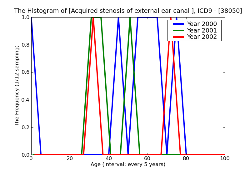 ICD9 Histogram Acquired stenosis of external ear canal unspecified as to cause