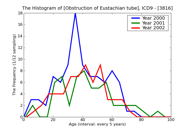 ICD9 Histogram Obstruction of Eustachian tube