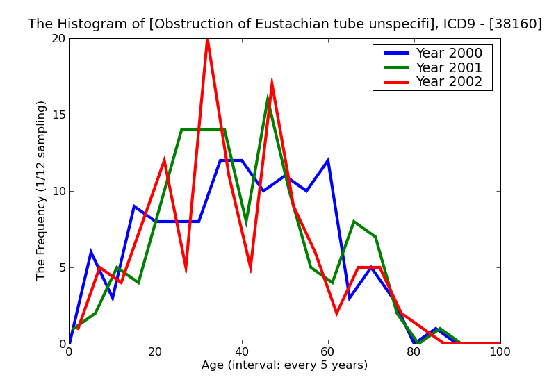 ICD9 Histogram Obstruction of Eustachian tube unspecified