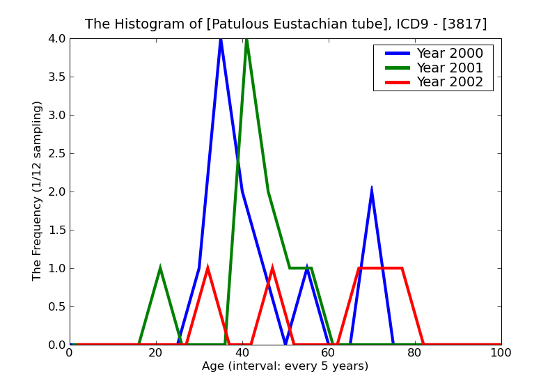 ICD9 Histogram Patulous Eustachian tube
