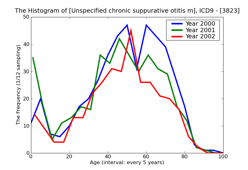 ICD9 Histogram Unspecified chronic suppurative otitis media