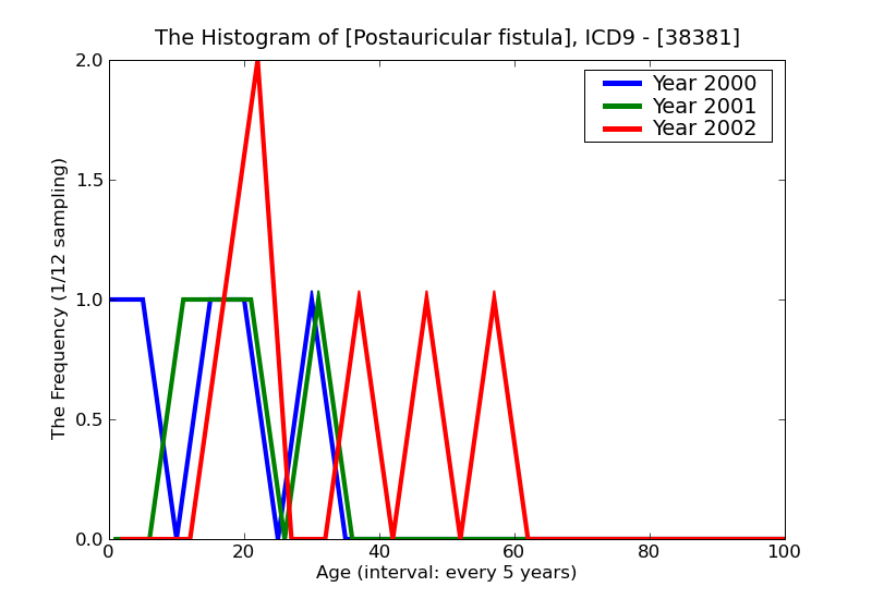 ICD9 Histogram Postauricular fistula