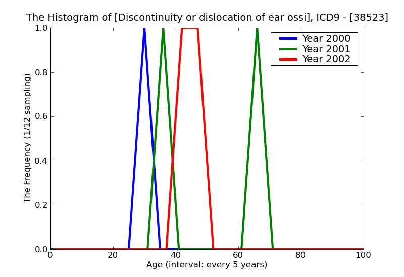 ICD9 Histogram Discontinuity or dislocation of ear ossicles