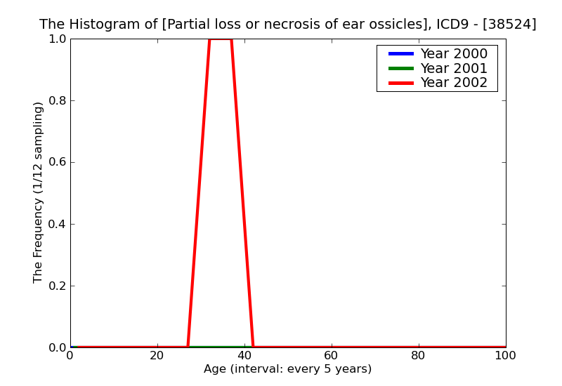 ICD9 Histogram Partial loss or necrosis of ear ossicles