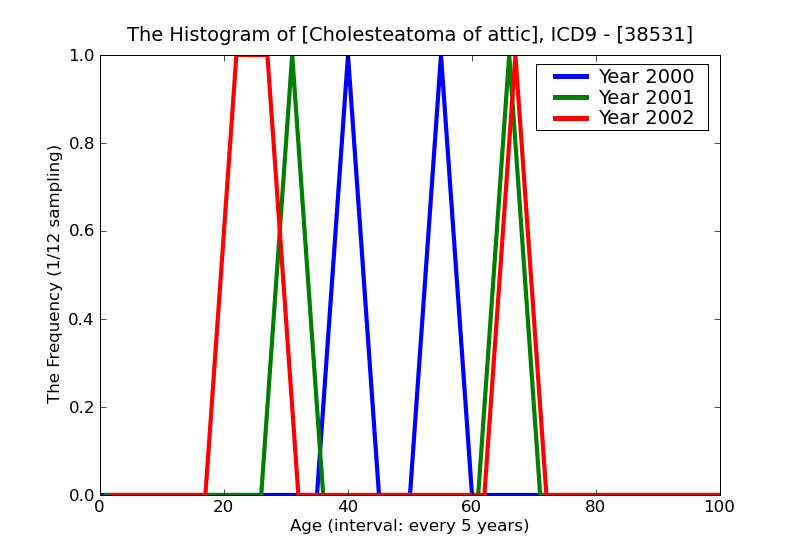 ICD9 Histogram Cholesteatoma of attic