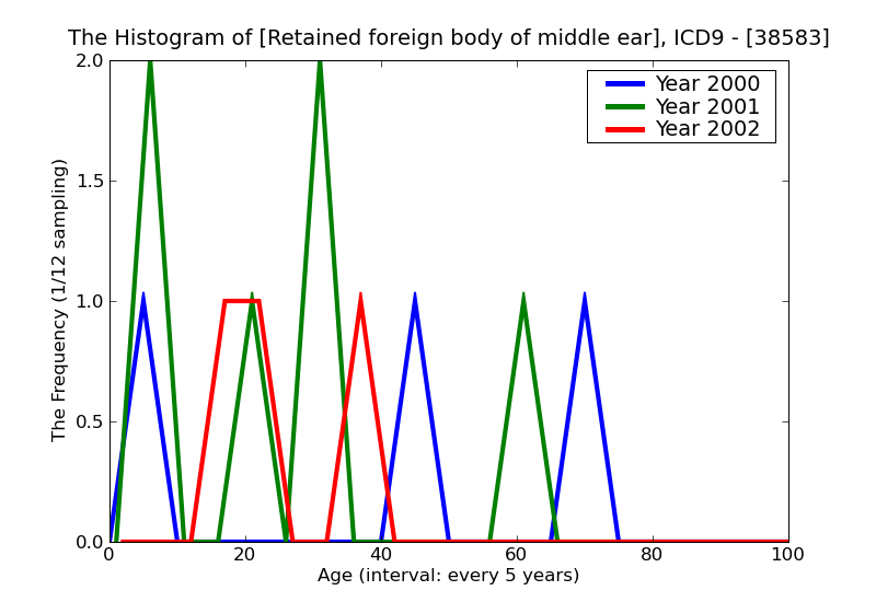 ICD9 Histogram Retained foreign body of middle ear