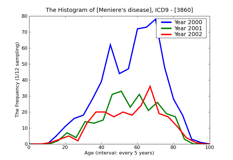 ICD9 Histogram Meniere