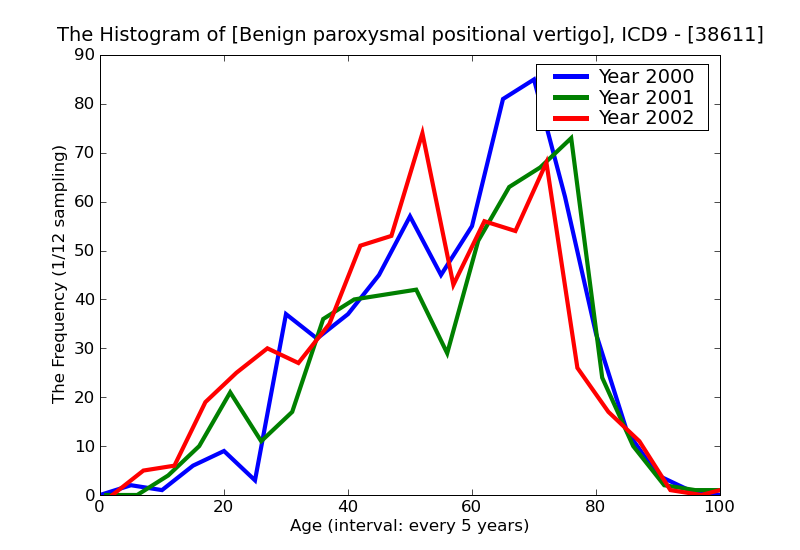 ICD9 Histogram Benign paroxysmal positional vertigo
