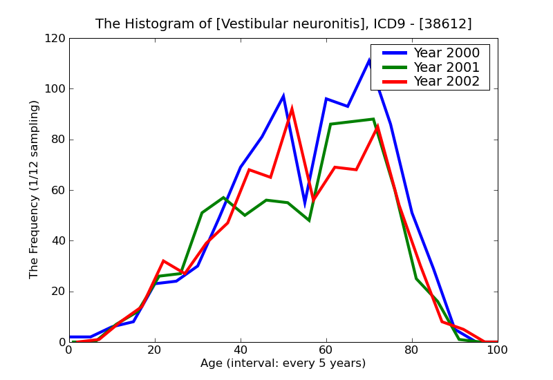 ICD9 Histogram Vestibular neuronitis