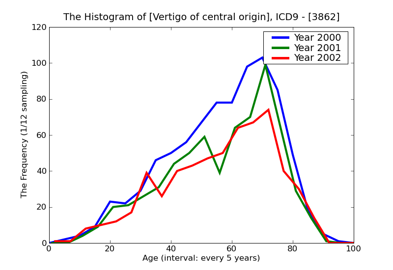 ICD9 Histogram Vertigo of central origin