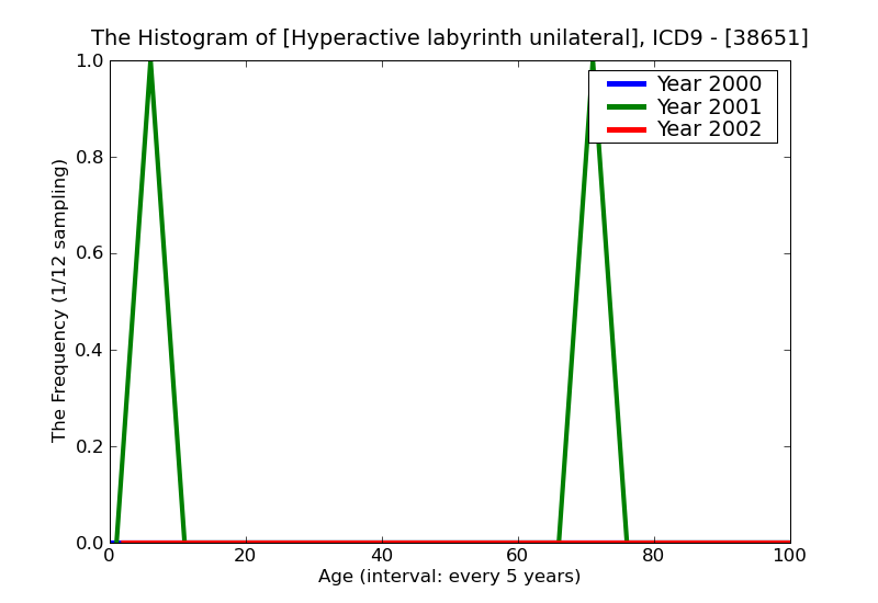 ICD9 Histogram Hyperactive labyrinth unilateral