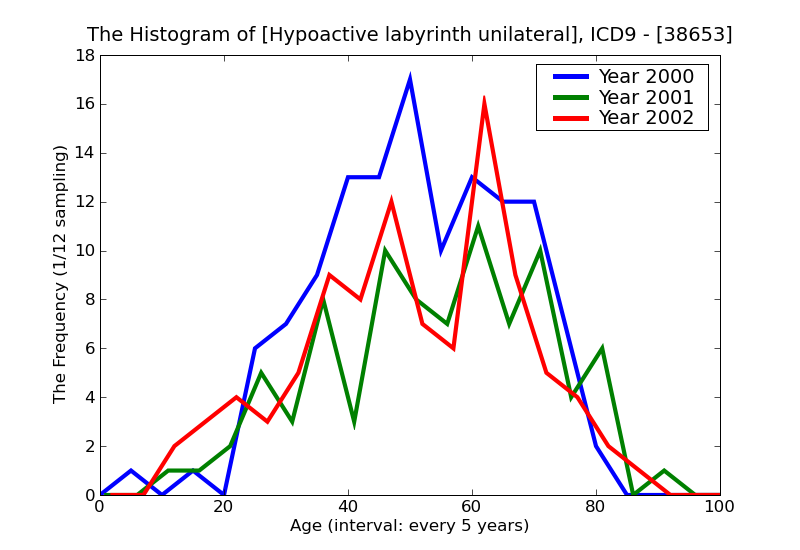 ICD9 Histogram Hypoactive labyrinth unilateral