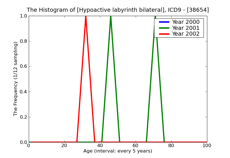 ICD9 Histogram Hypoactive labyrinth bilateral