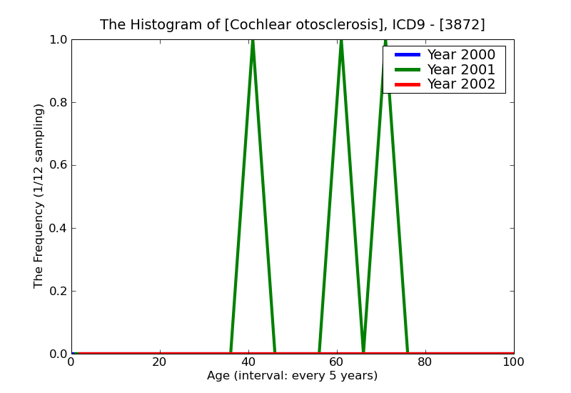 ICD9 Histogram Cochlear otosclerosis